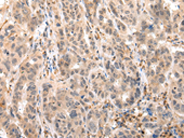 Rabbit Polyclonal Antibody to EPHB4