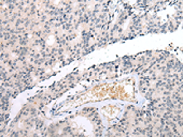 Rabbit Polyclonal Antibody to DUSP9