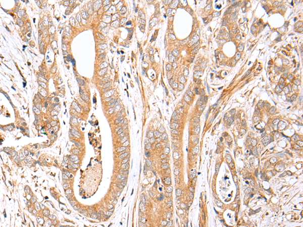Rabbit Polyclonal Antibody to FPR1