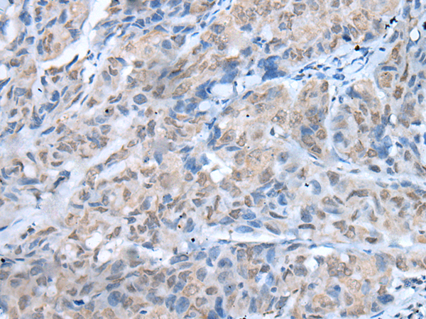 Rabbit Polyclonal Antibody to TMEM97
