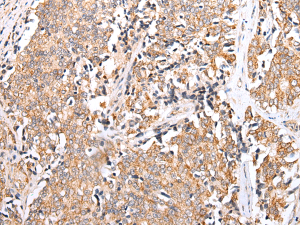 Rabbit Polyclonal Antibody to PPP1R15A