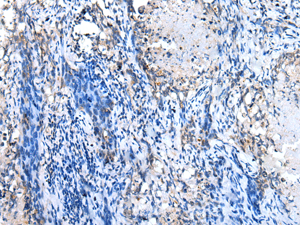 Rabbit Polyclonal Antibody to GJB1