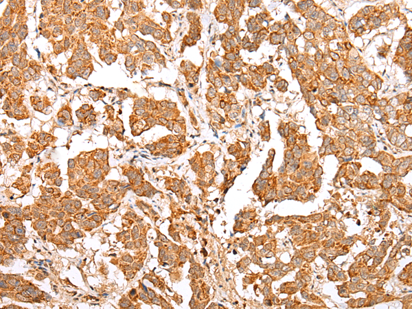 Rabbit Polyclonal Antibody to NLRP1