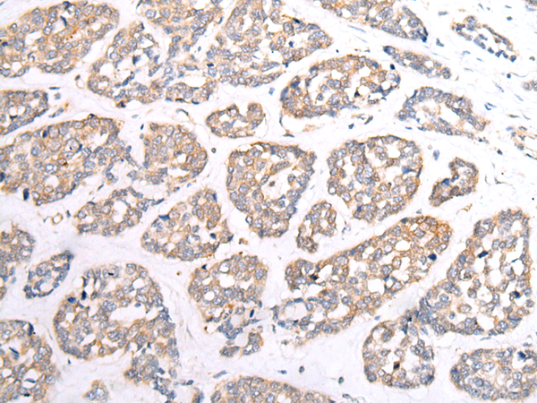 Rabbit Polyclonal Antibody to HTR1B