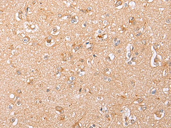 Rabbit Polyclonal Antibody to HTR2A