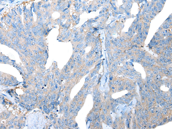 Rabbit Polyclonal Antibody to LAMP1