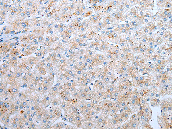 Rabbit Polyclonal Antibody to CD209