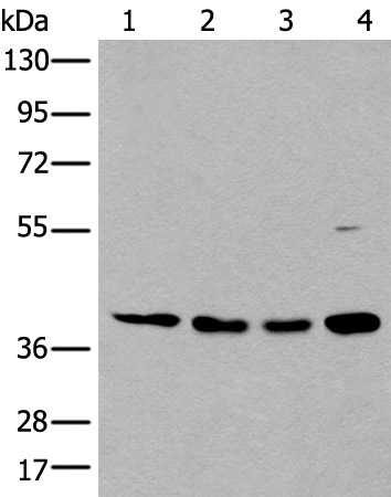 Rabbit Polyclonal Antibody to MAFB