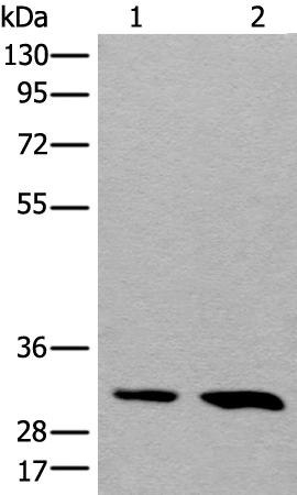 Rabbit Polyclonal Antibody to HOXD8