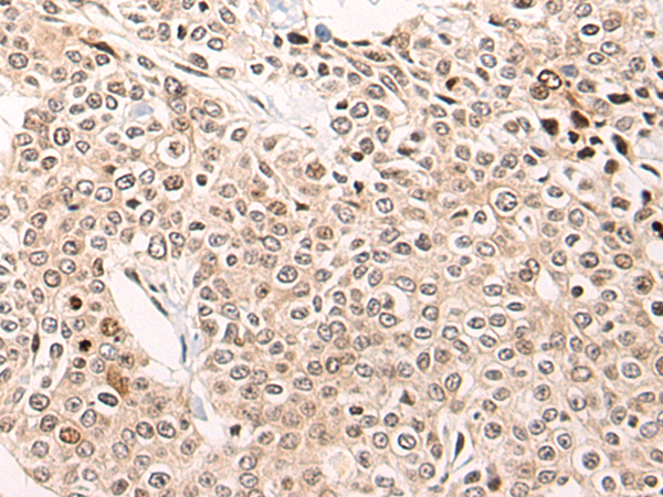 Rabbit Polyclonal Antibody to HSF4