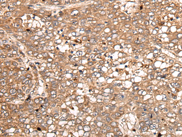 Rabbit Polyclonal Antibody to IGFBP2
