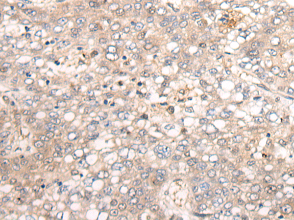 Rabbit Polyclonal Antibody to LDLR
