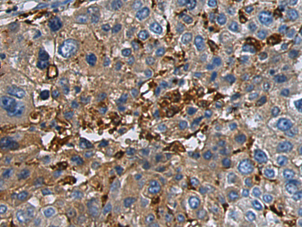 Rabbit Polyclonal Antibody to GABRB1