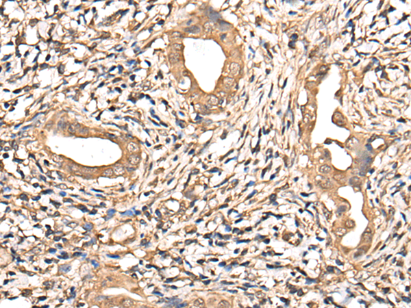 Rabbit Polyclonal Antibody to ABCC4