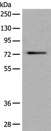 Rabbit Polyclonal Antibody to MTA2