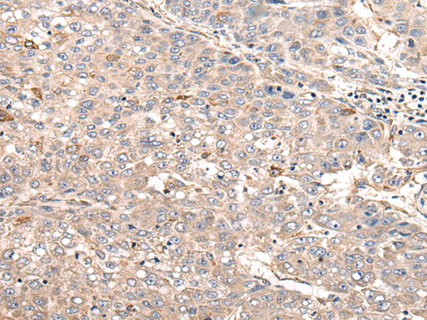 Rabbit Polyclonal Antibody to MYLK