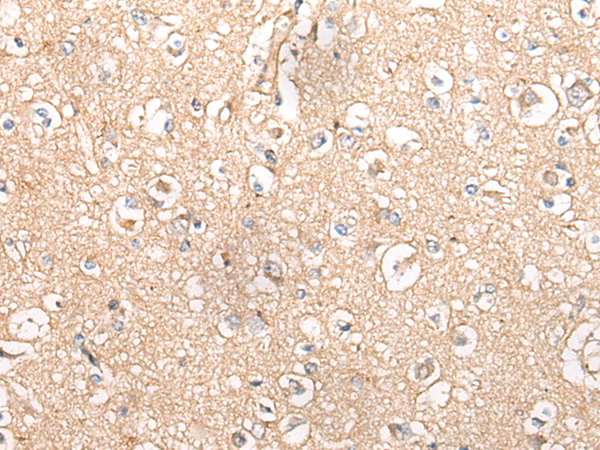 Rabbit Polyclonal Antibody to MTNR1B