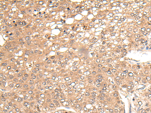 Rabbit Polyclonal Antibody to CHRNA6