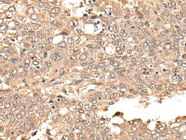 Rabbit Polyclonal Antibody to NES