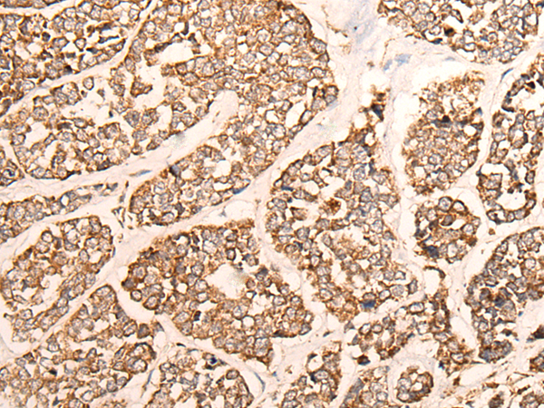 Rabbit Polyclonal Antibody to GRIA4