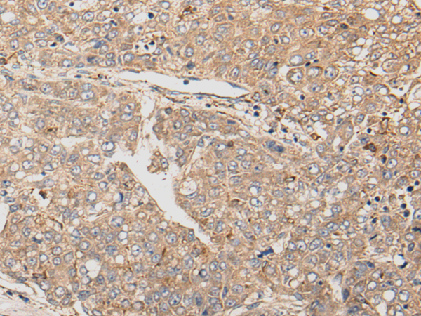 Rabbit Polyclonal Antibody to LPAR6