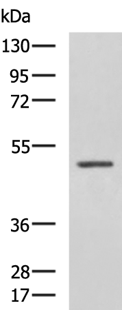 Rabbit Polyclonal Antibody to GFAP