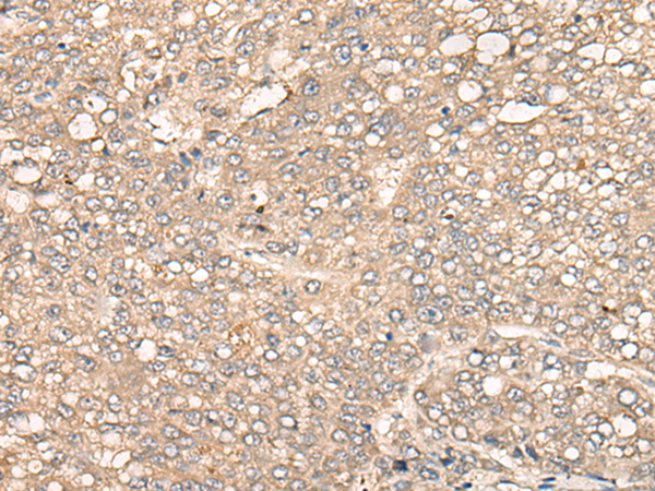 Rabbit Polyclonal Antibody to F2RL1