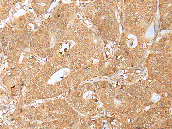 Rabbit Polyclonal Antibody to PEG3