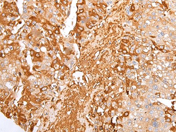 Rabbit Polyclonal Antibody to A2M