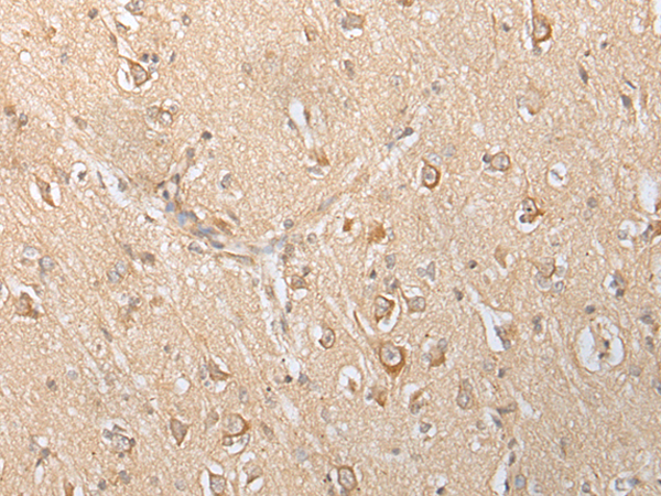 Rabbit Polyclonal Antibody to SLC25A21