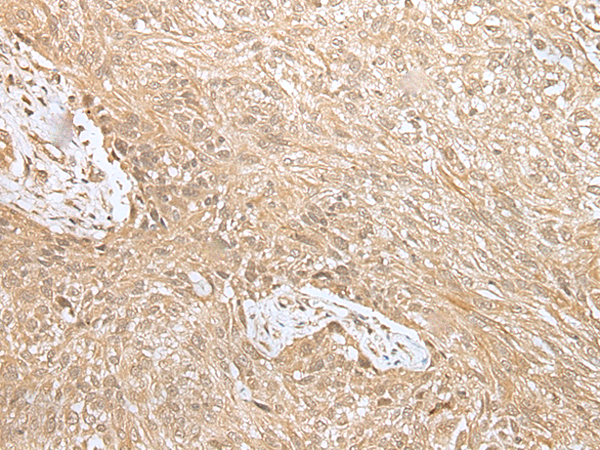 Rabbit Polyclonal Antibody to NPHS1
