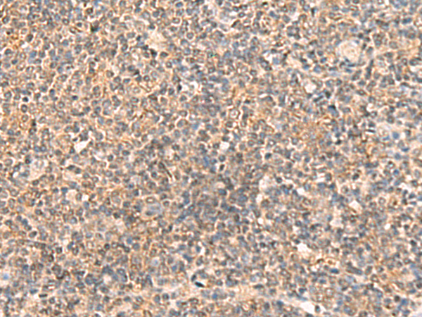 Rabbit Polyclonal Antibody to ABCB4