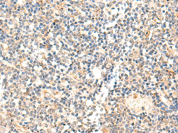 Rabbit Polyclonal Antibody to ADAMTS2
