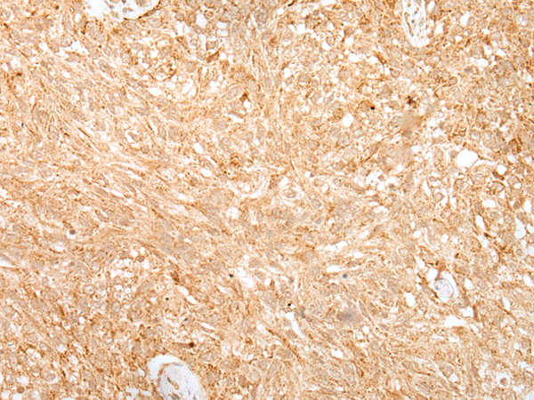 Rabbit Polyclonal Antibody to ADAMTS3