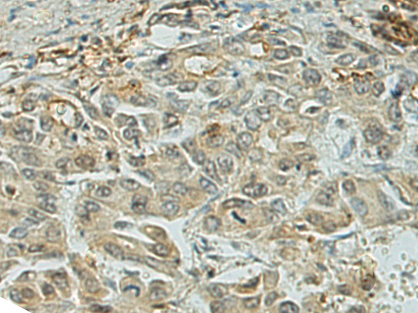 Rabbit Polyclonal Antibody to ADAMTS8