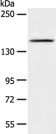 Rabbit Polyclonal Antibody to AGL