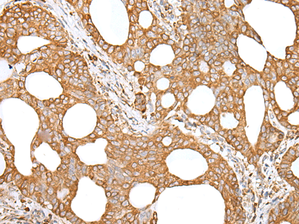 Rabbit Polyclonal Antibody to GANAB