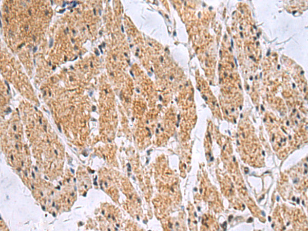 Rabbit Polyclonal Antibody to SLC4A3