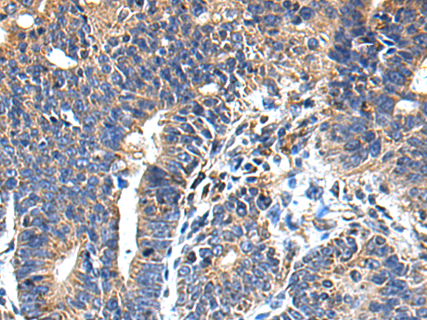 Rabbit Polyclonal Antibody to NTN1