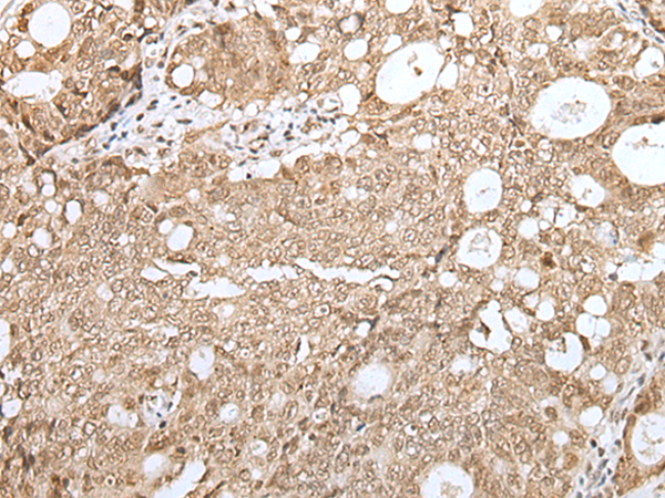 Rabbit Polyclonal Antibody to BIRC7