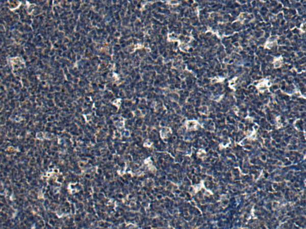 Rabbit Polyclonal Antibody to CHRNB2