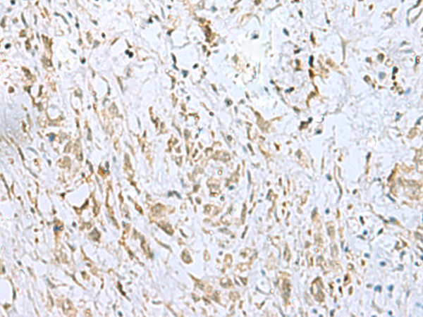 Rabbit Polyclonal Antibody to ECT2