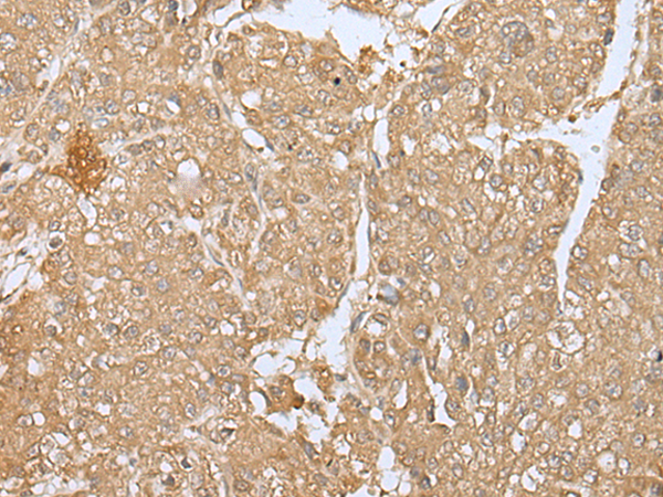 Rabbit Polyclonal Antibody to SMARCA1