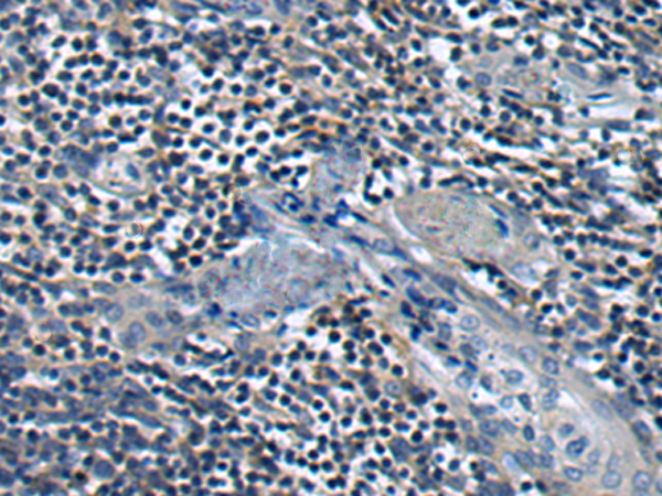 Rabbit Polyclonal Antibody to CCR4
