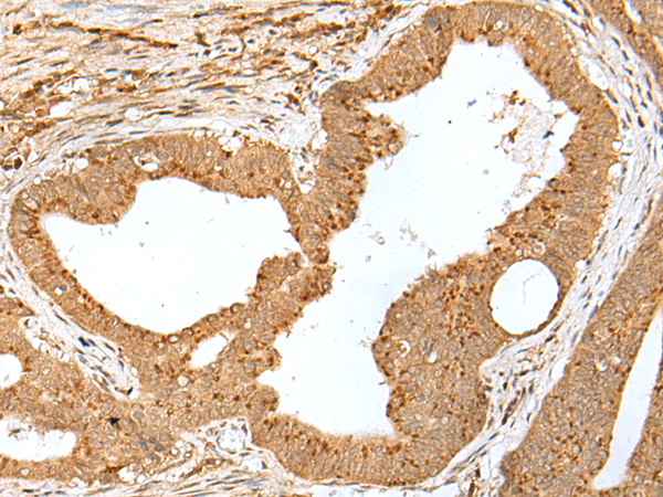 Rabbit Polyclonal Antibody to JUNB