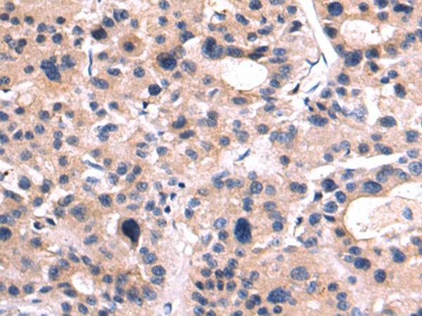 Rabbit Polyclonal Antibody to CX3CR1