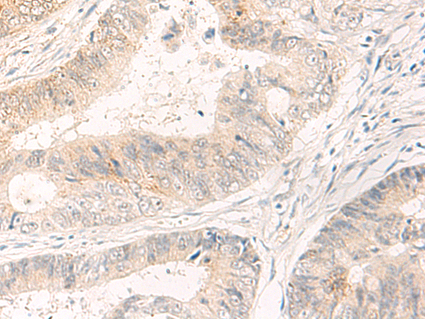 Rabbit Polyclonal Antibody to SYT16