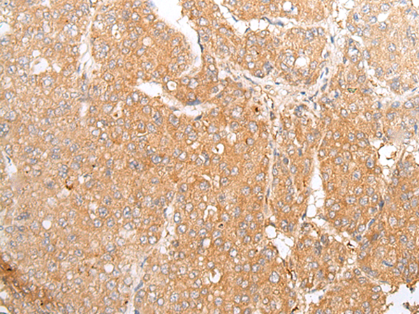 Rabbit Polyclonal Antibody to TMEM107