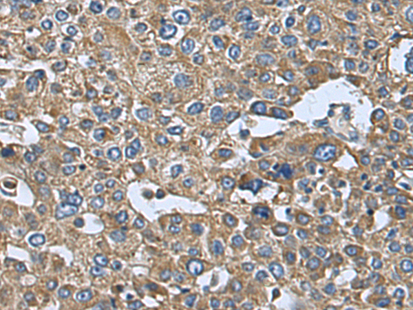 Rabbit Polyclonal Antibody to DOK6