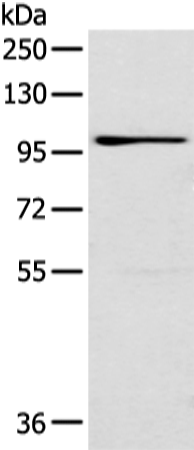 Rabbit Polyclonal Antibody to E2F8